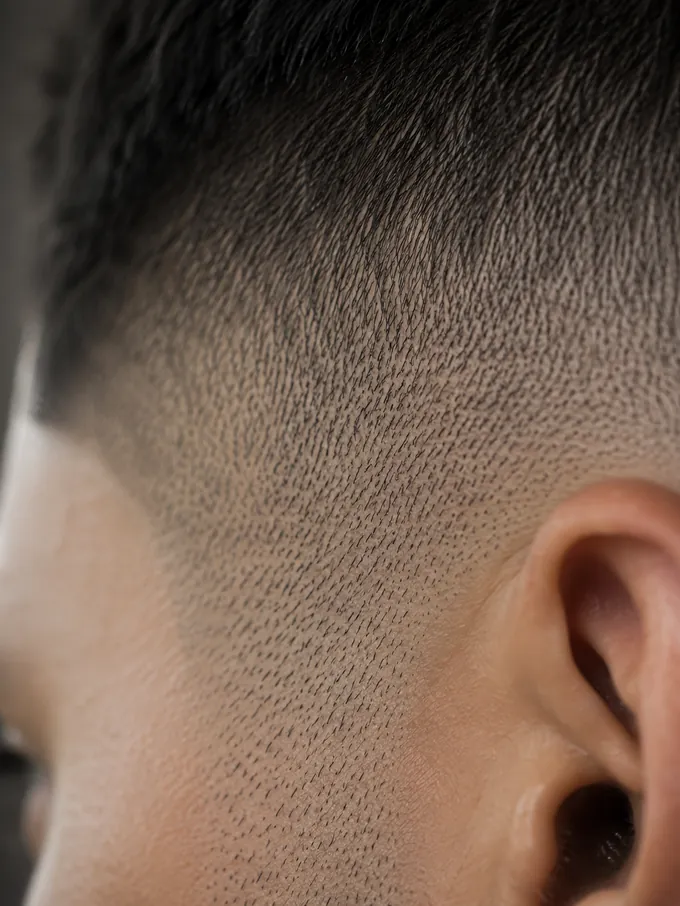 Close-up of skin fade regrowth showing stubble pushing through bare scalp